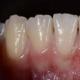 Эрдэмтдийн боловсруулсан Норбеков, Шичко нарын дагуу авсан шүдийг нөхөн сэргээх эсвэл шинээр ургуулах арга